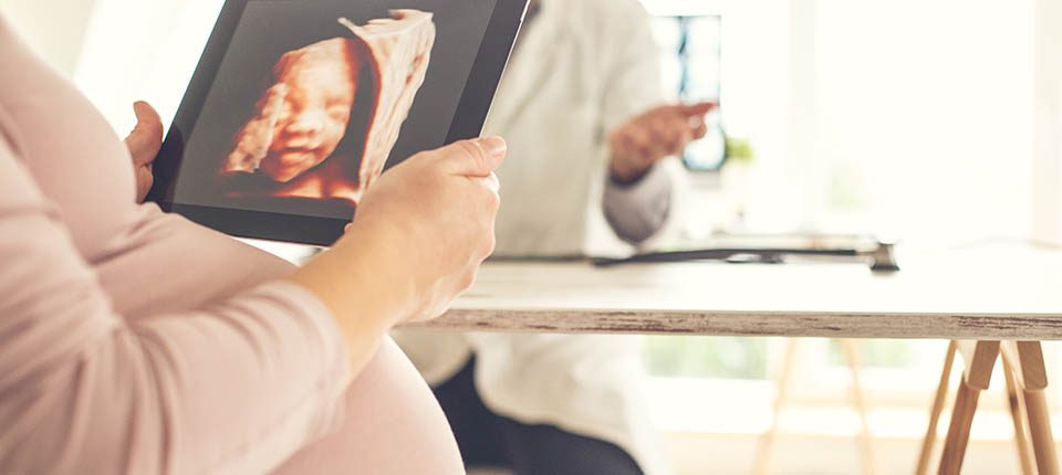 Doctor showing ultrasound image of baby to pregnant mother